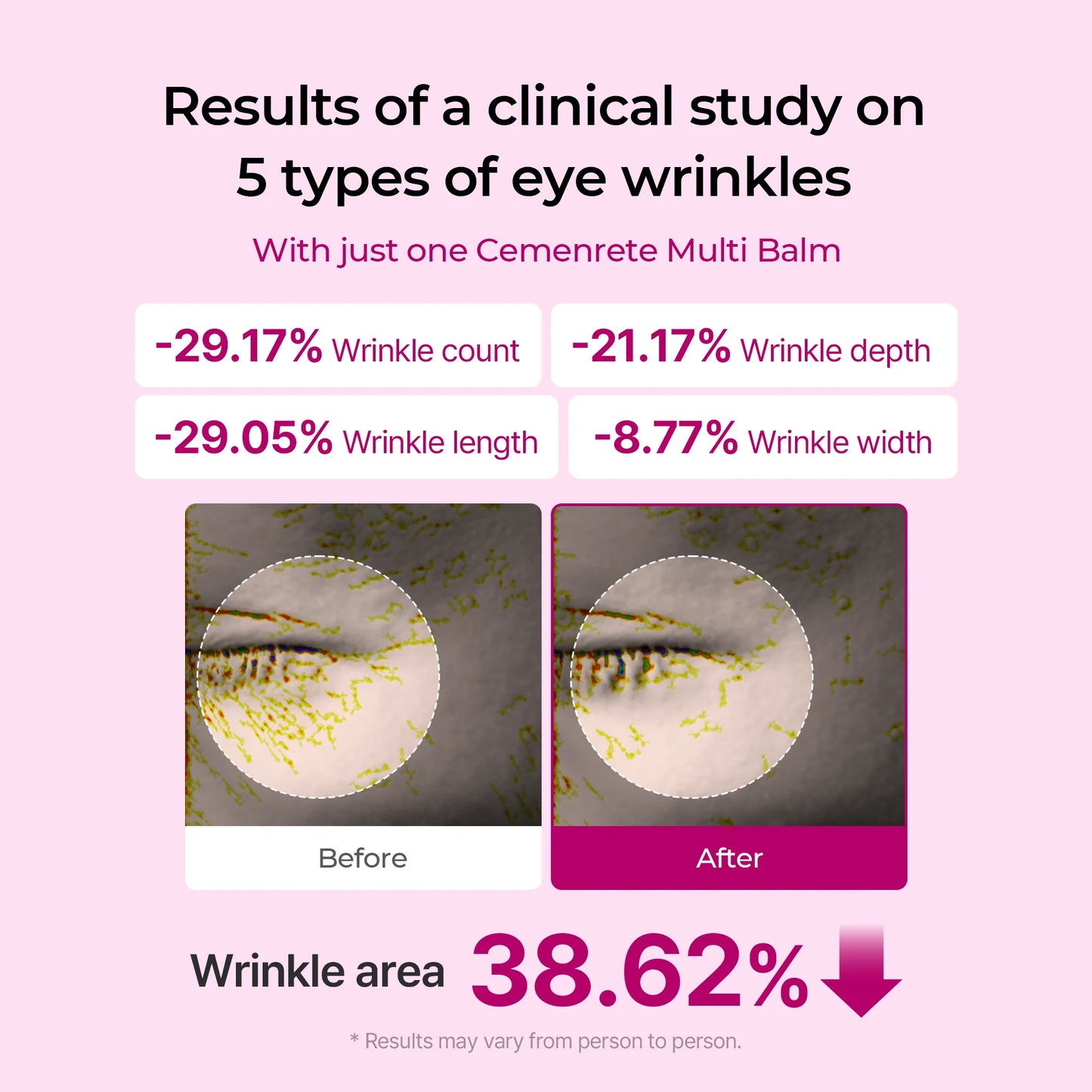 [Dr.Melaxin Official]Cemenrete Calcium Multi Balm 9g