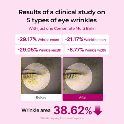 [Dr.Melaxin Official]Cemenrete Calcium Multi Balm 9g